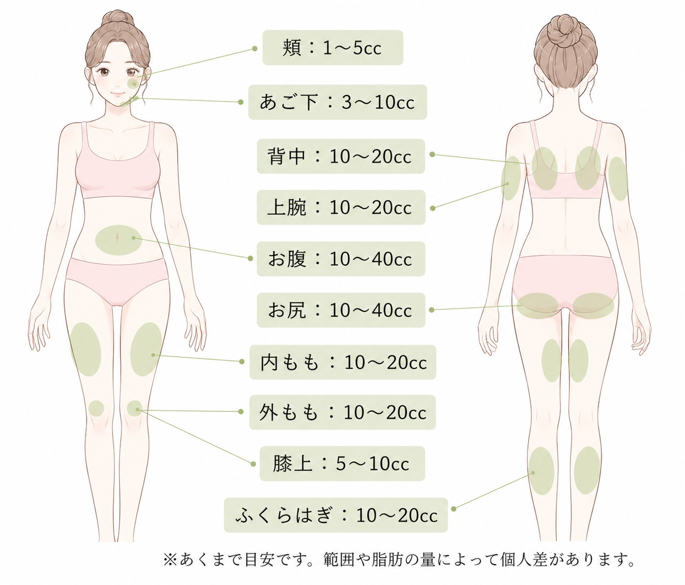 脂肪溶解注射 注入部位・目安量