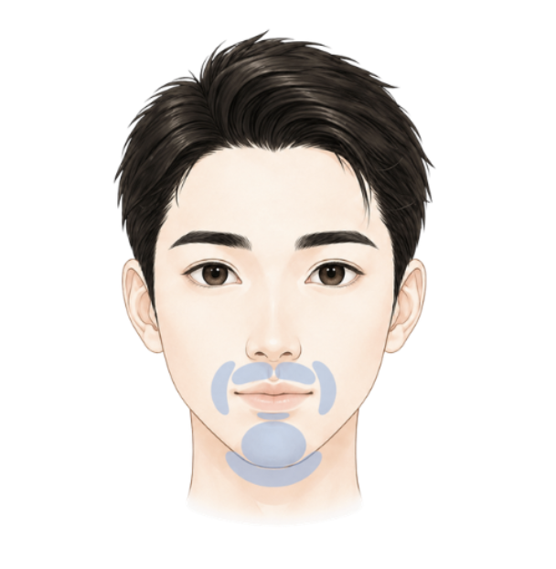 男性 髭脱毛