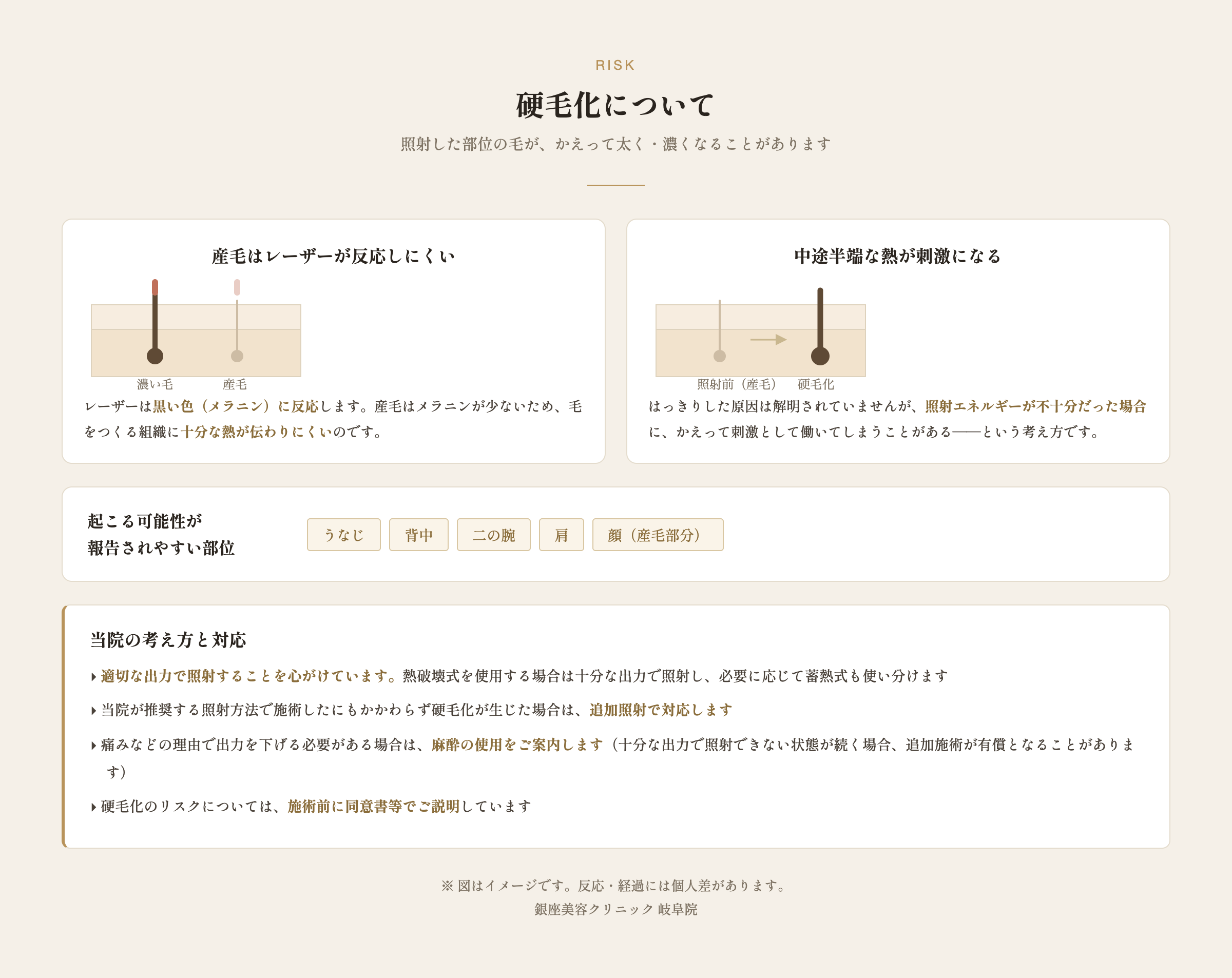 硬毛化が起こる理由と、起こりやすい部位・当院の対応の図解