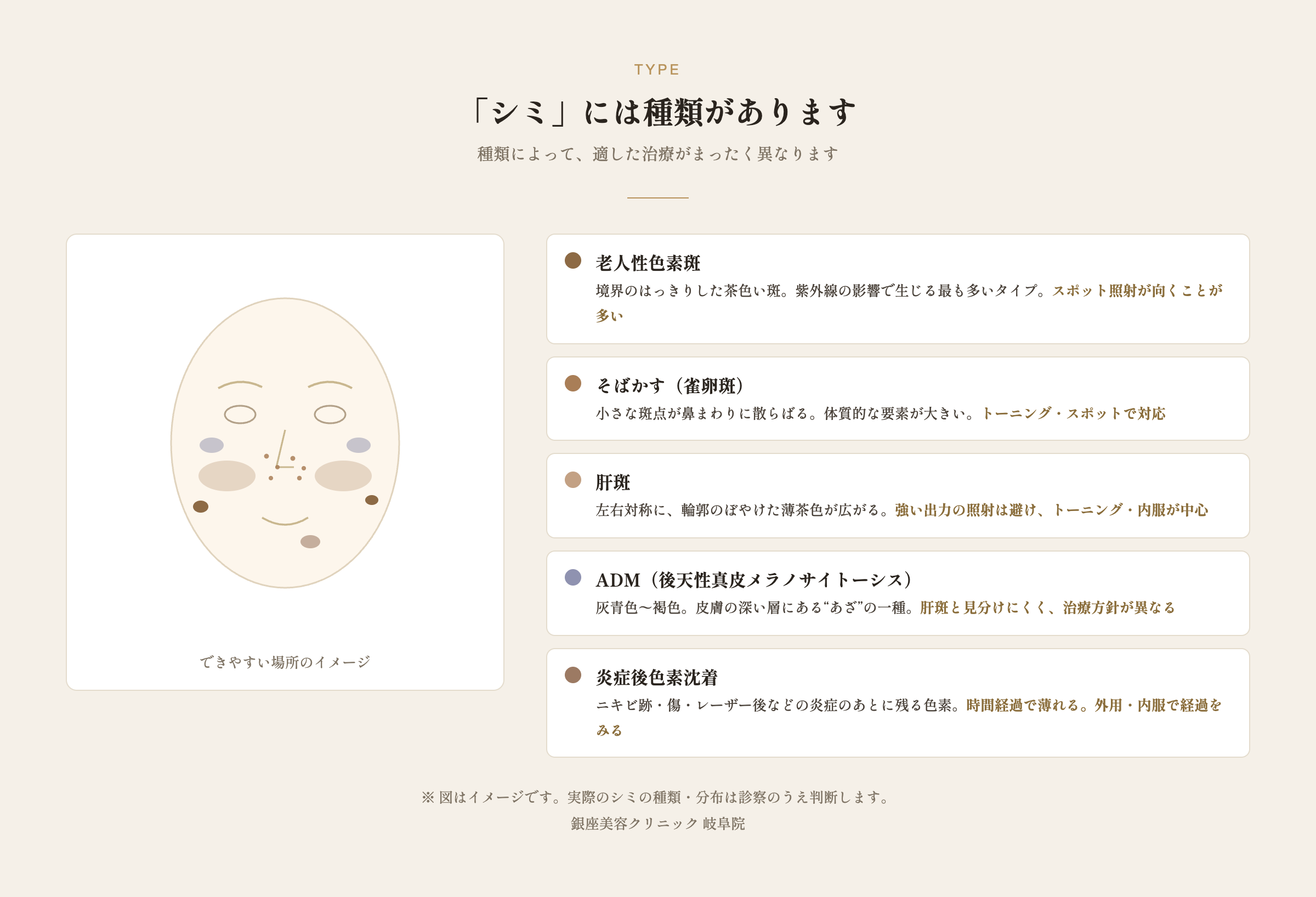 シミの種類(老人性色素斑・そばかす・肝斑・ADM・炎症後色素沈着)と、できやすい場所の図解
