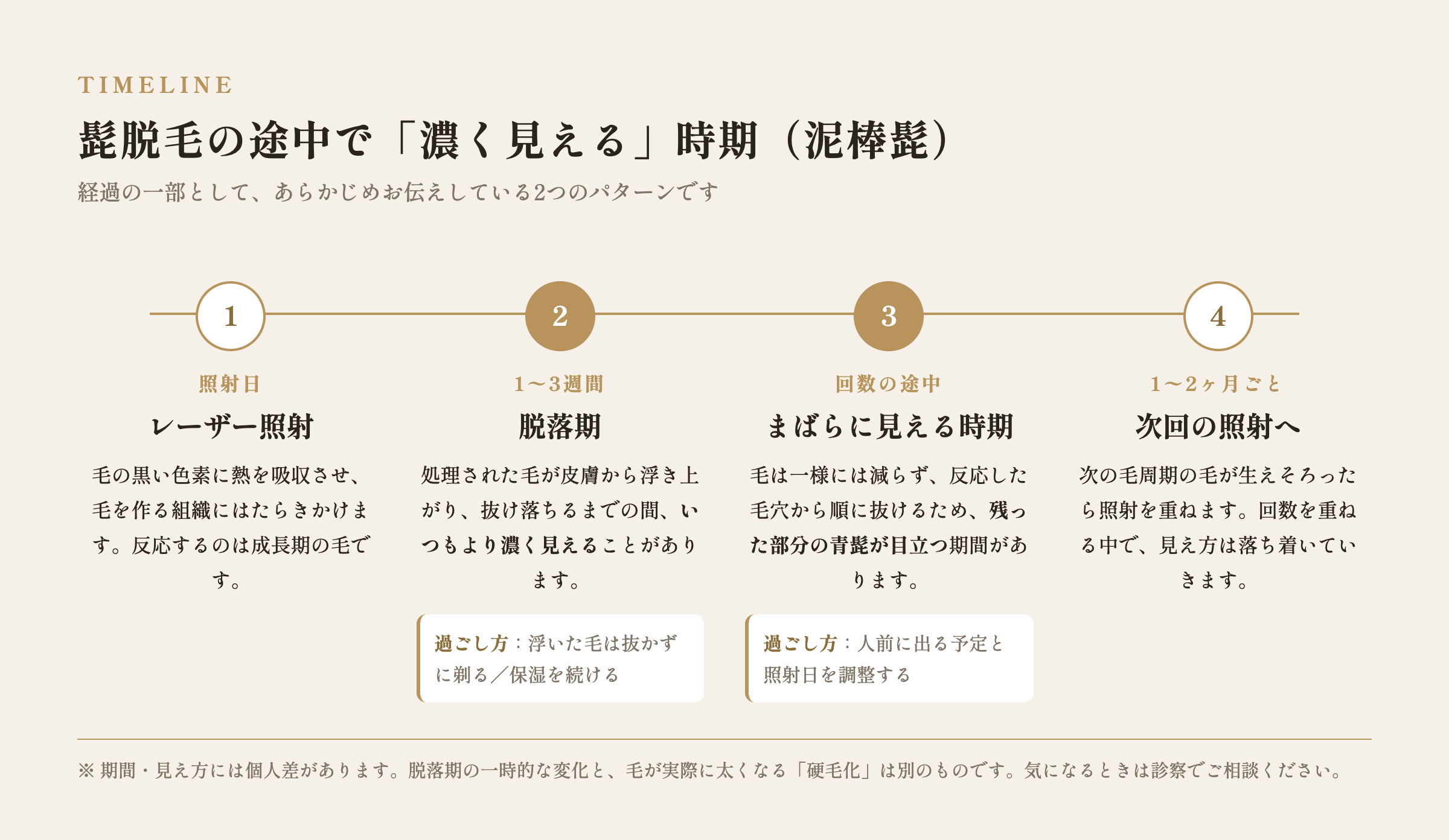 髭脱毛の途中で一時的に濃く見える「泥棒髭」の経過(脱落期・まばらに見える時期)の図解
