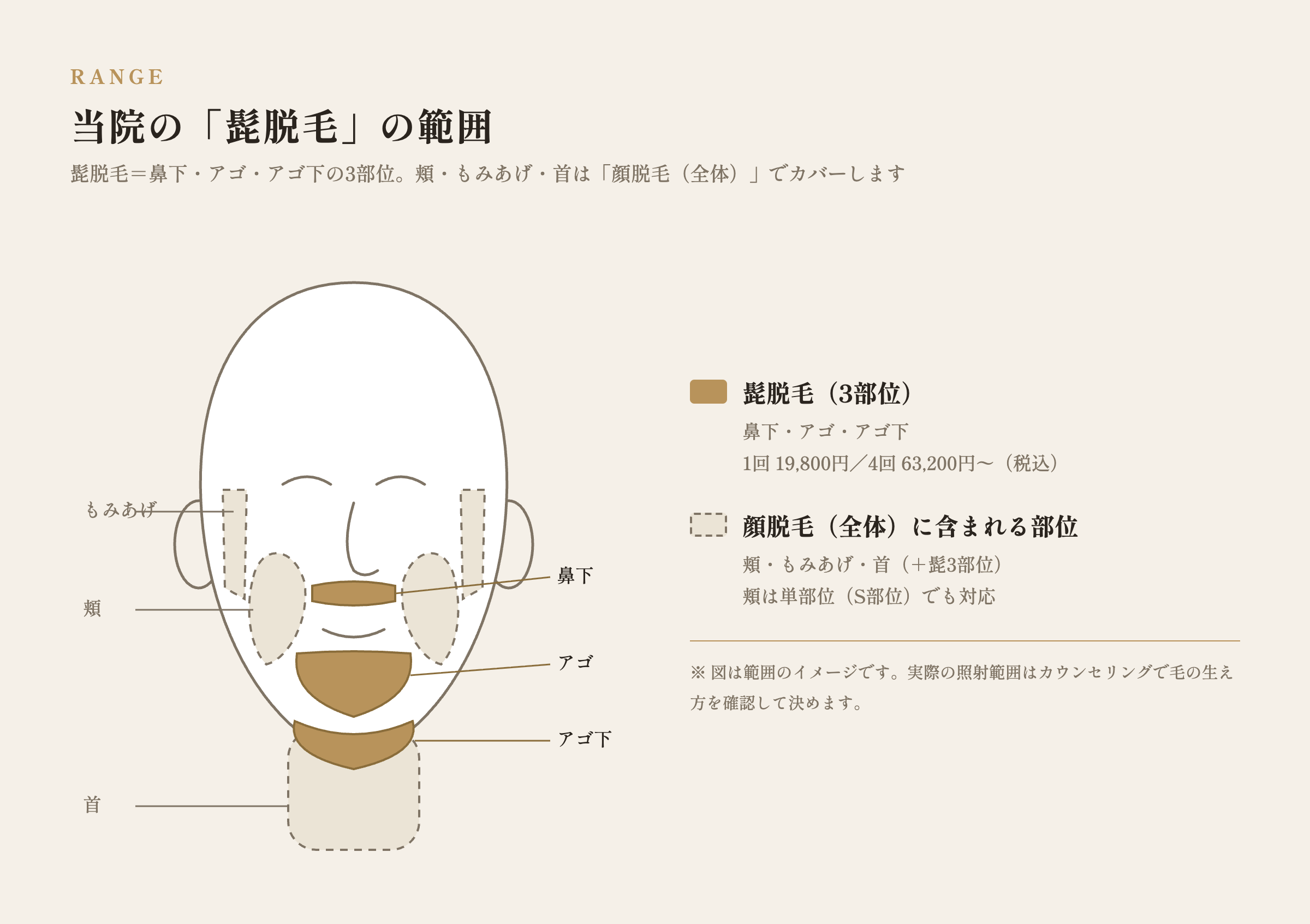 当院の髭脱毛の範囲(鼻下・アゴ・アゴ下)と、顔脱毛(全体)に含まれる部位の図解